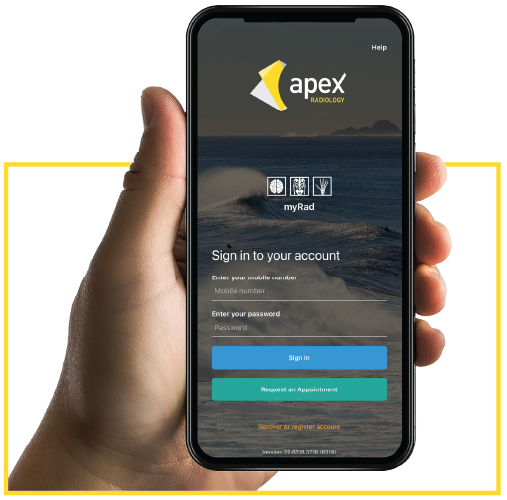 Hand holding a phone with the apex radiology app against a transparent background.